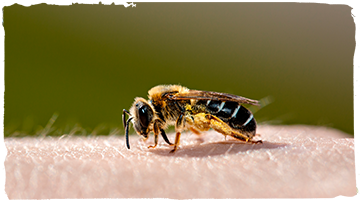 La picadura de abeja
